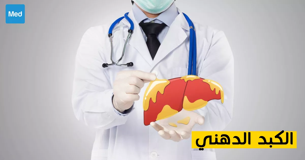 الكبد الدهني